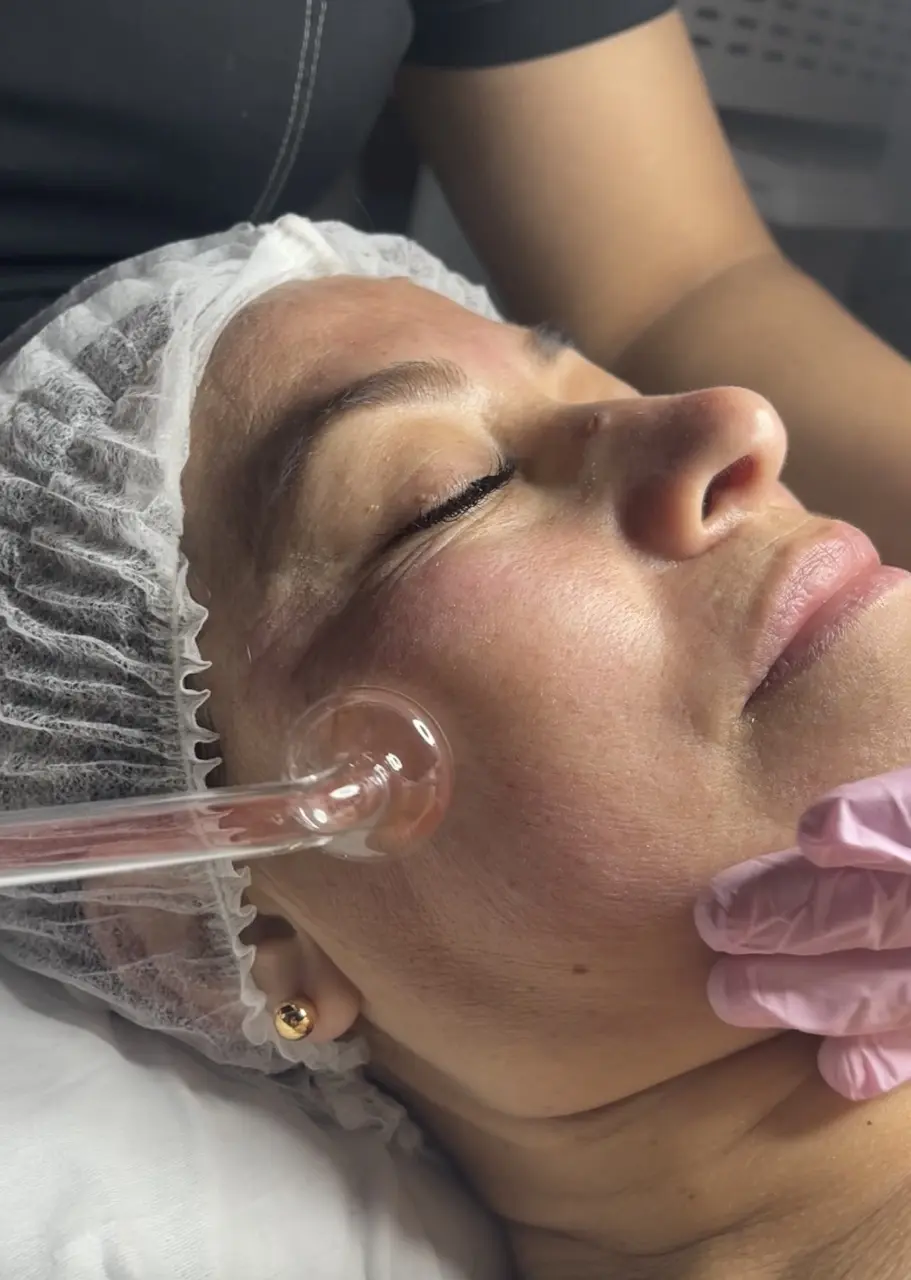 Limpieza Facial Profunda en Chía
